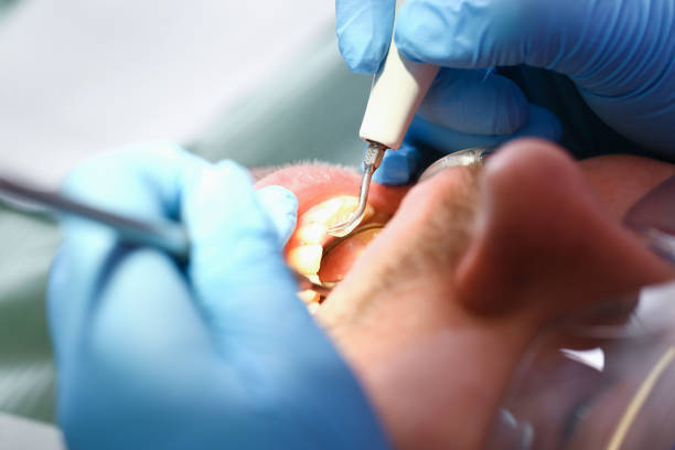 Best Emergency Tooth Extraction  in Bernice, LA