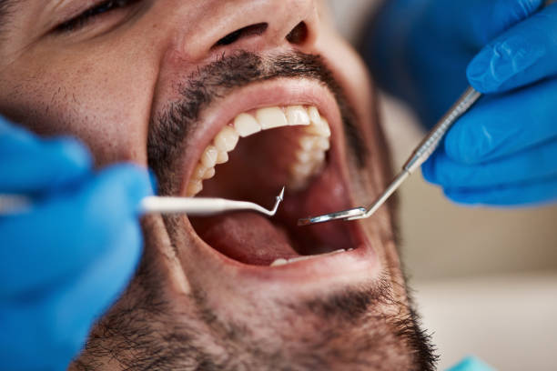 Best Walk-In Dentist Near Me  in Bernice, LA
