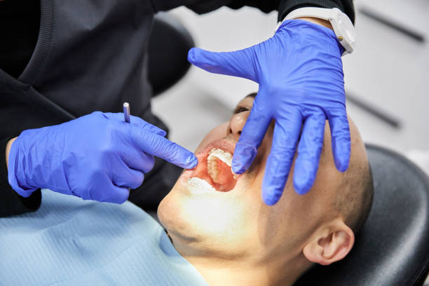 Best Knocked-Out Tooth Emergency  in Bernice, LA