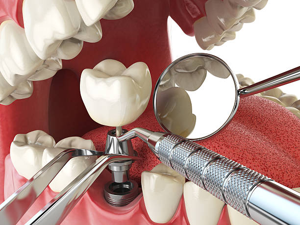  Bernice, LA Emergency Dentist Pros