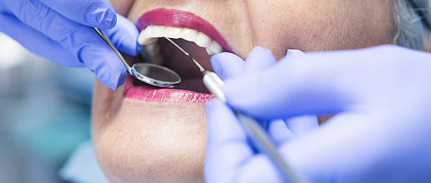 Best Emergency Tooth Extraction  in Bernice, LA